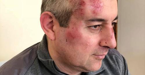Сиражутдин Дациев. Фото Екатерины Сокирянской (RFE/RL) Сиражутдин Дациев. Фото Екатерины Сокирянской (RFE/RL)