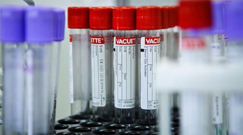 Лабораторные анализы. Фото Елены Синеок, Юга.ру
