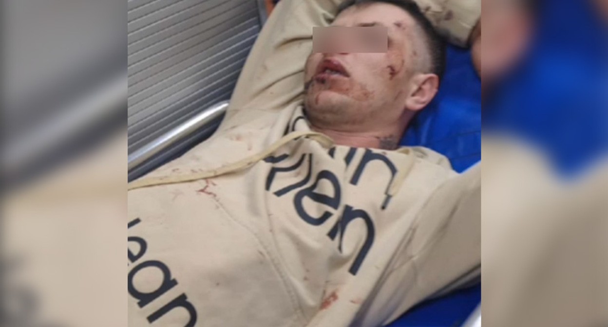 Подвергшийся нападению в Ростове-на-Дону ветеран СВО после избиения. Кадр из видео https://vk.com/wall-88393165_832042 Подвергшийся нападению в Ростове-на-Дону ветеран СВО после избиения. Кадр из видео https://vk.com/wall-88393165_832042