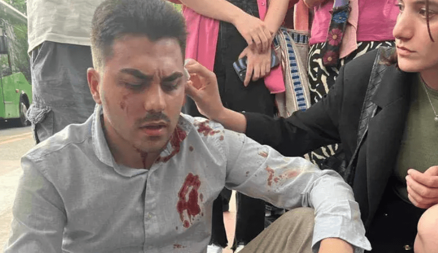 Нико Манагадзе после нападения. Скриншот фото "Интерпрессньюс" от 07.06.24, https://www.interpressnews.ge/ru/article/160822-fizicheski-raspravilis-s-liderom-studencheskogo-dvizheniia-za-svobodu-niko-managadze
