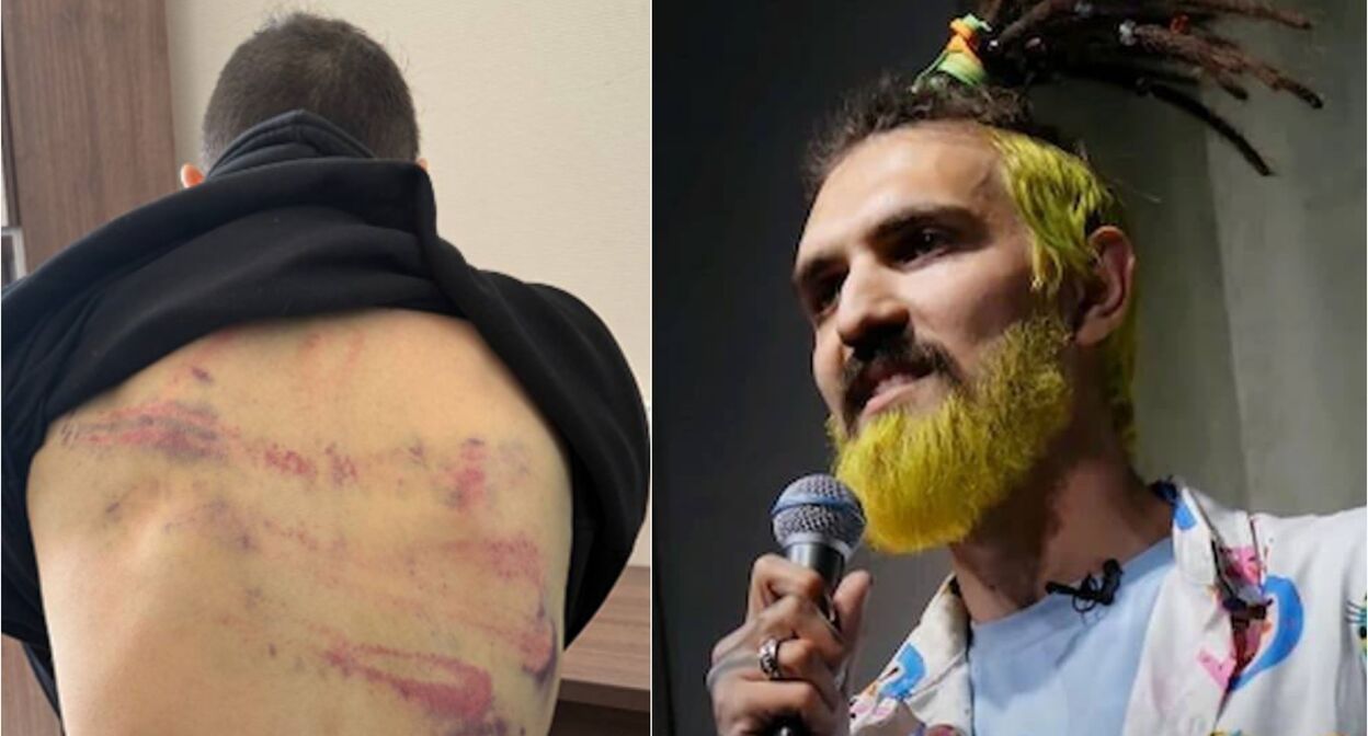 Артемий Останин со следами побоев после задержания и ранее на сцене. Фото: https://t.me/Merkacheva/3467, Telegram-канал "Москва 24"
